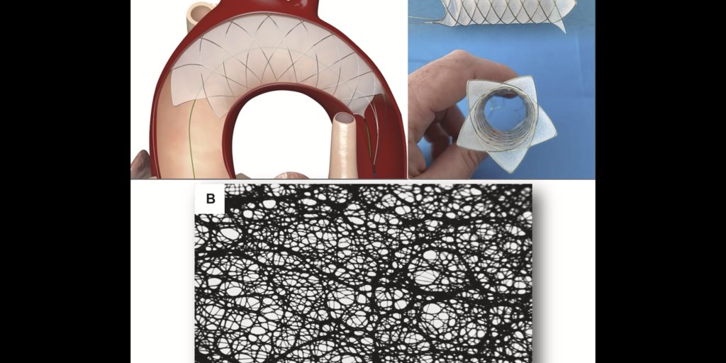omendiz's tweet card. The device covers three vessels at once and can be deployed through the patient's TAVR access site. Researchers shared their first-in-human experience in JACC: Case Reports.