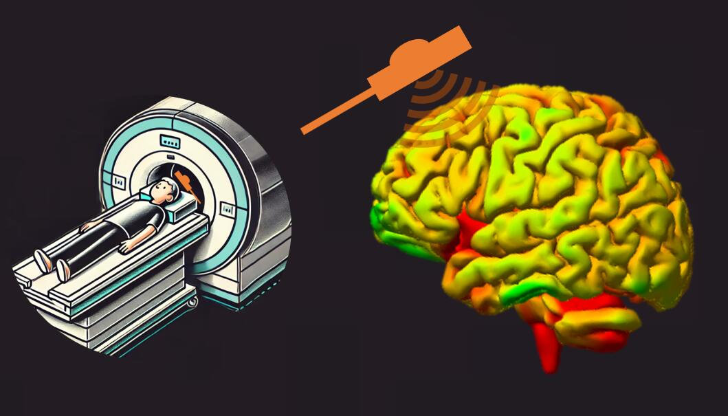 TranslationalNI's tweet card. This 1-hour presentation will cover the following points: 1. How can we combine TMS with fMRI? 2. How could they aid each other? 3. How to apply therapeutic theta burst protocols inside an MRI 4....