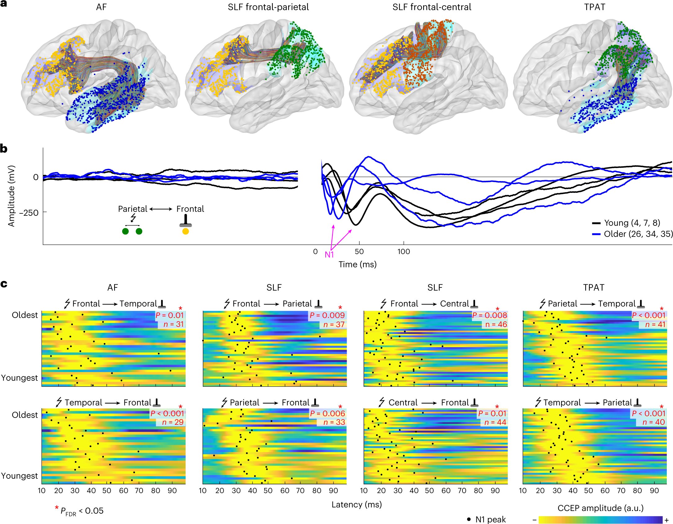 dora_hermes's tweet card. Nature Neuroscience - This study mapped the developmental trajectory of transmission speed in the human brain by using electrical pulses and intracranial recordings. The authors found that these...