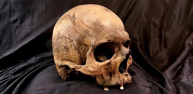 CharitieHartsig's tweet card. Zoonoses—diseases that spread from animals to humans—began to gain prevalence some 6,500 years ago with the rise of animal husbandry, a new study suggests