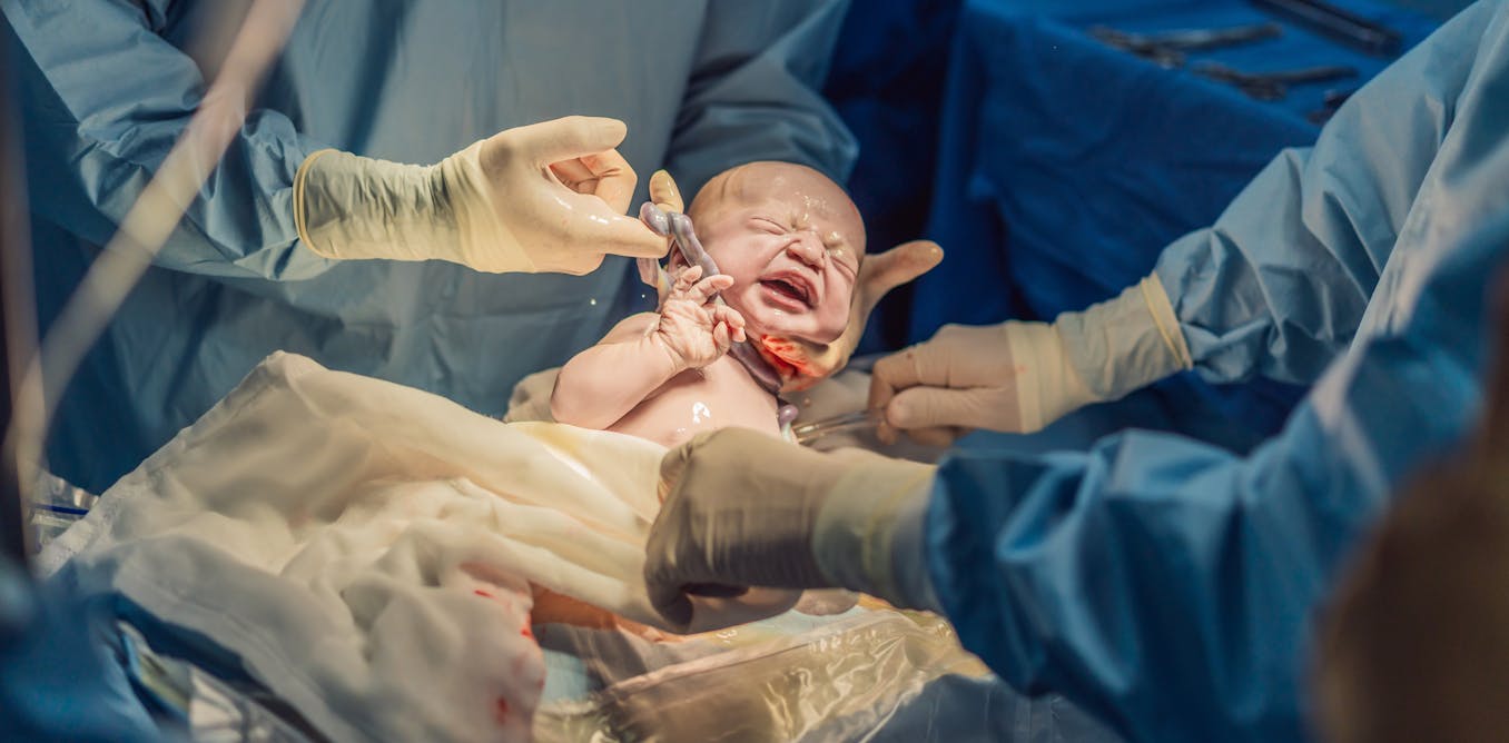 lunduniversity's tweet card. Umbilical cord pH test could help identify babies at risk of brain damage and disabilities.