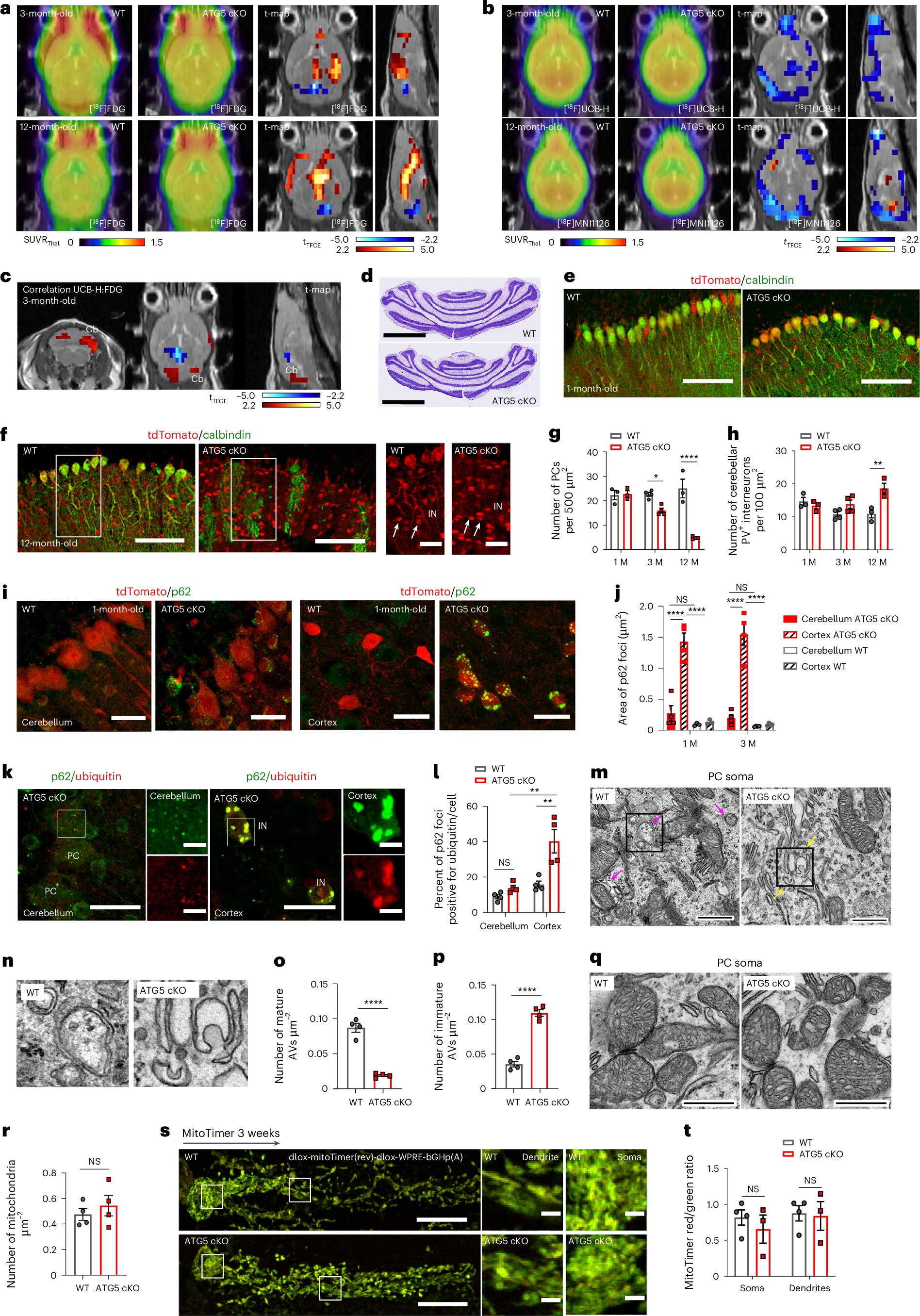 KononenkoLab's tweet card. Nature Metabolism - Tutas et al. show an unconventional role for autophagy in the regulation of glycolytic flux in cerebellar Purkinje cells by maintaining the levels of the glucose transporter GLUT2.