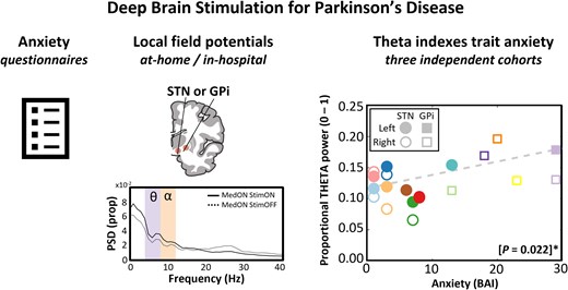 littleneuro's tweet card. Swinnen et al. explored the neural basis of anxiety in Parkinson's disease by examining brain activity in patients with implanted deep brain stimulation el