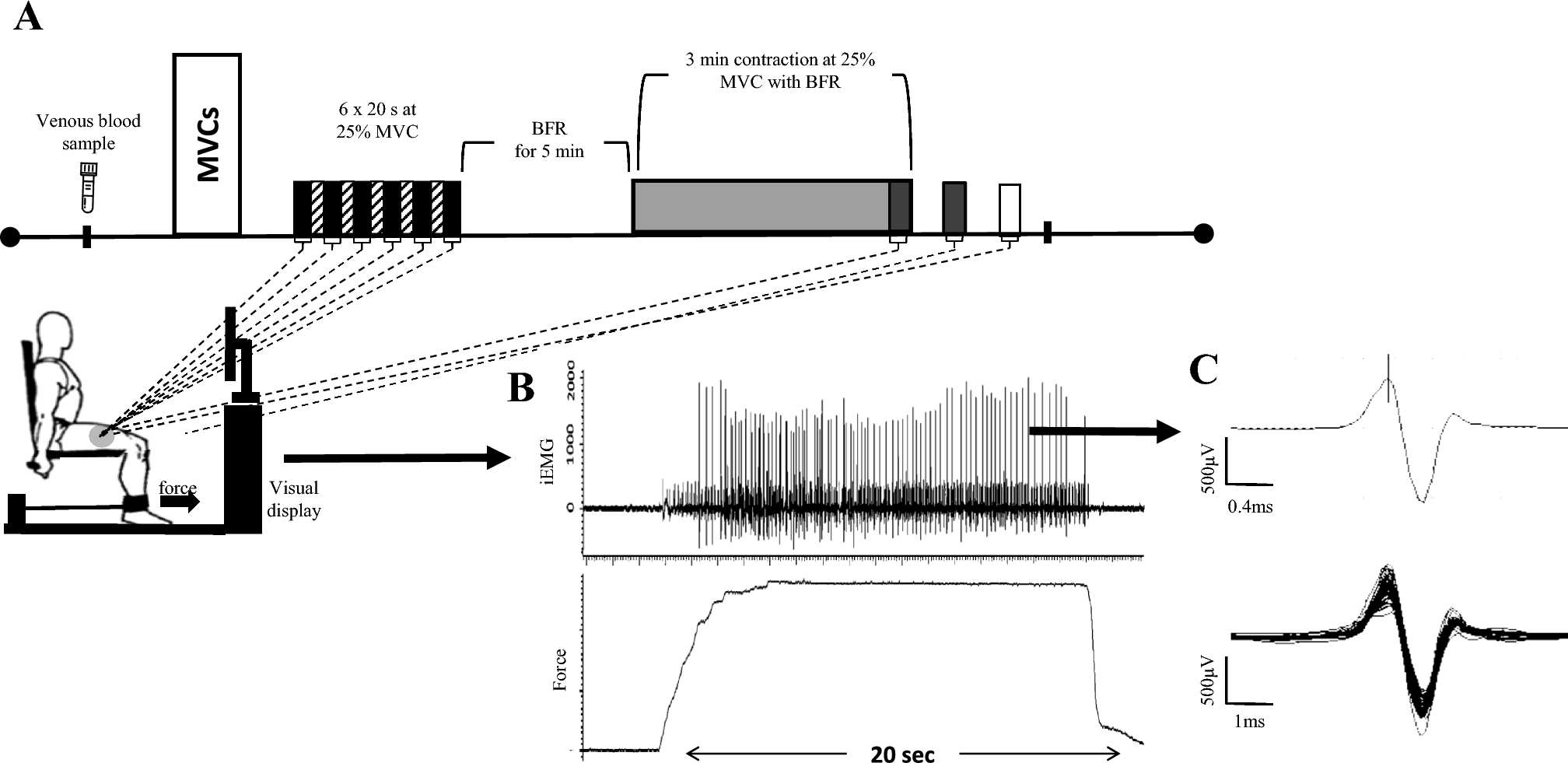 ozcan_esen's tweet card. European Journal of Nutrition - Dietary nitrate (NO3−) supplementation enhances muscle blood flow and metabolic efficiency in hypoxia, however, its efficacy on neuromuscular function and...