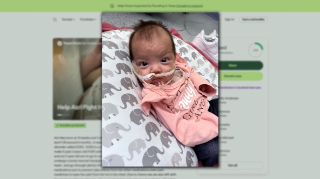 KLBKNews's tweet card. A Lubbock family said they were already struggling to support their family when doctors gave the news that their baby girl Azri was diagnosed with SCIDS, a rare autoimmune disorder.