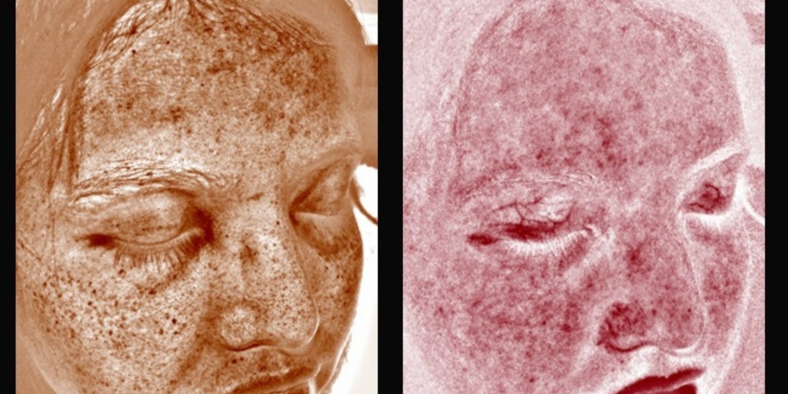 CUCancerCenter's tweet card. A UV camera lets the Office of Community Outreach and Engagement show teens their sun damage, plus tips on using sunscreen effectively.
