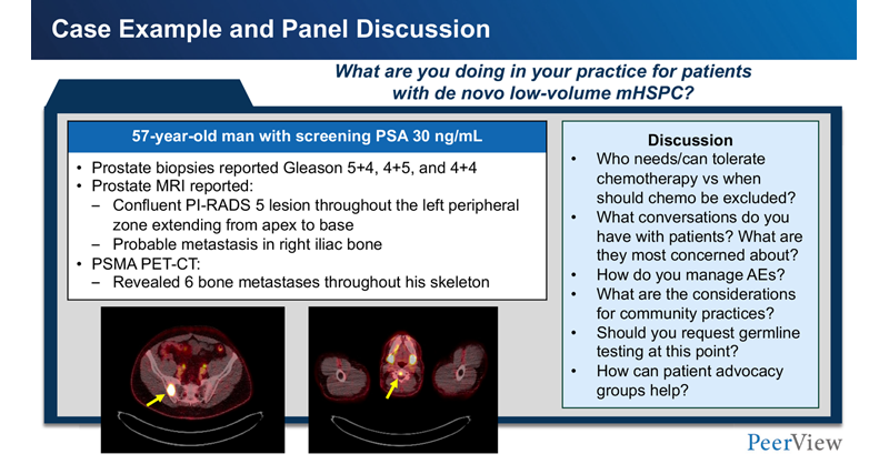 PeerView's tweet card. See a new #prostatecancer activity via @PeerView @ecastromarcos #ASCO25 #Oncology #MedEd