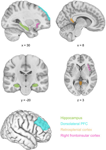 MillerLabMIT's tweet card. Nobre and Gresch call for an upgrade of attention research by considering how the brain shifts its focus between contents in the external sensory stream and internal memory representations. They...