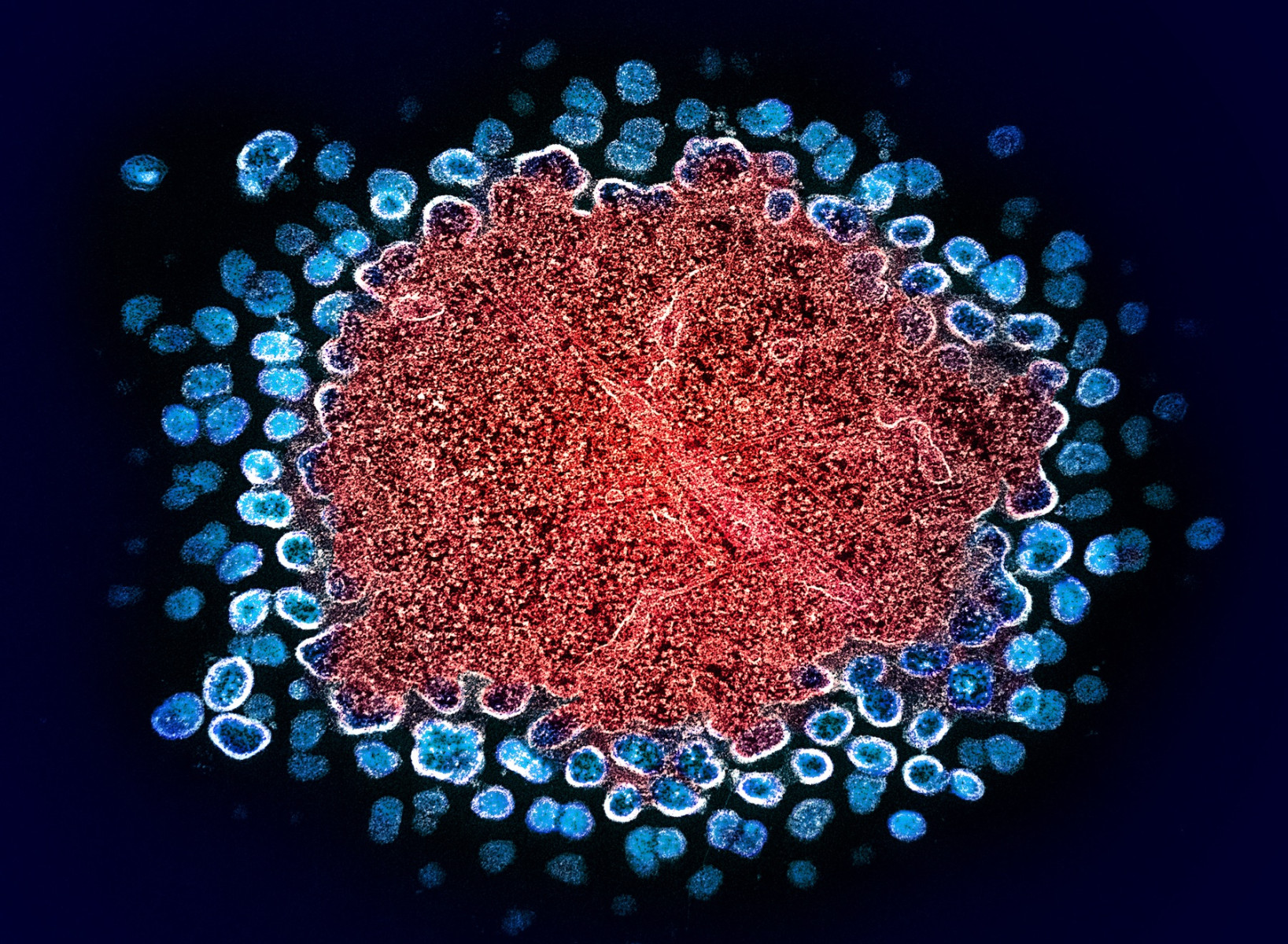 OSU_RNA's tweet card. A chemical modification in the HIV-1 RNA genome whose function has been a matter of scientific debate is now confirmed to be key to the virus’s ability to survive and thrive after infecting host...