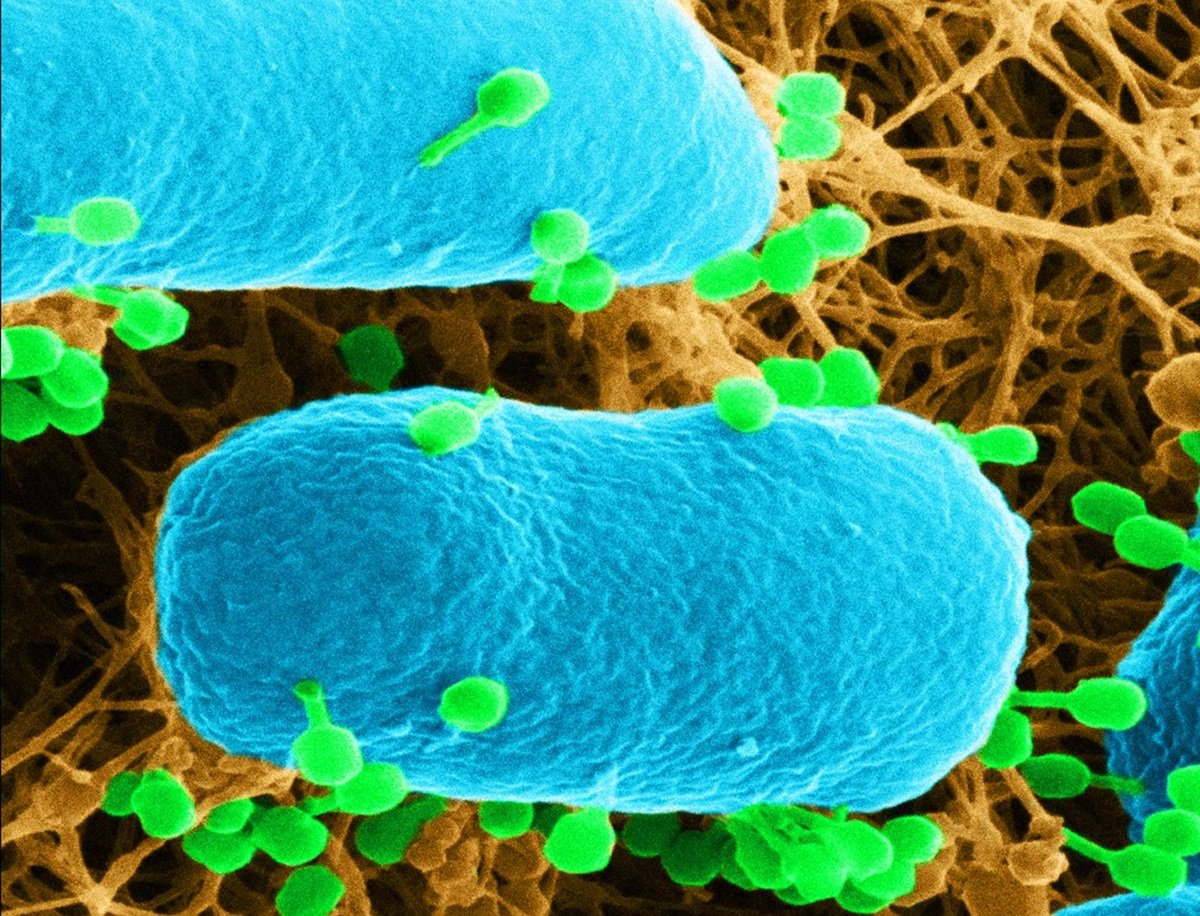 AlonsoFelipeRu's tweet card. Phages that are used for therapy are lytic, which means that they infect and destroy bacterial cells, effectively preventing the onward spread of infection.
