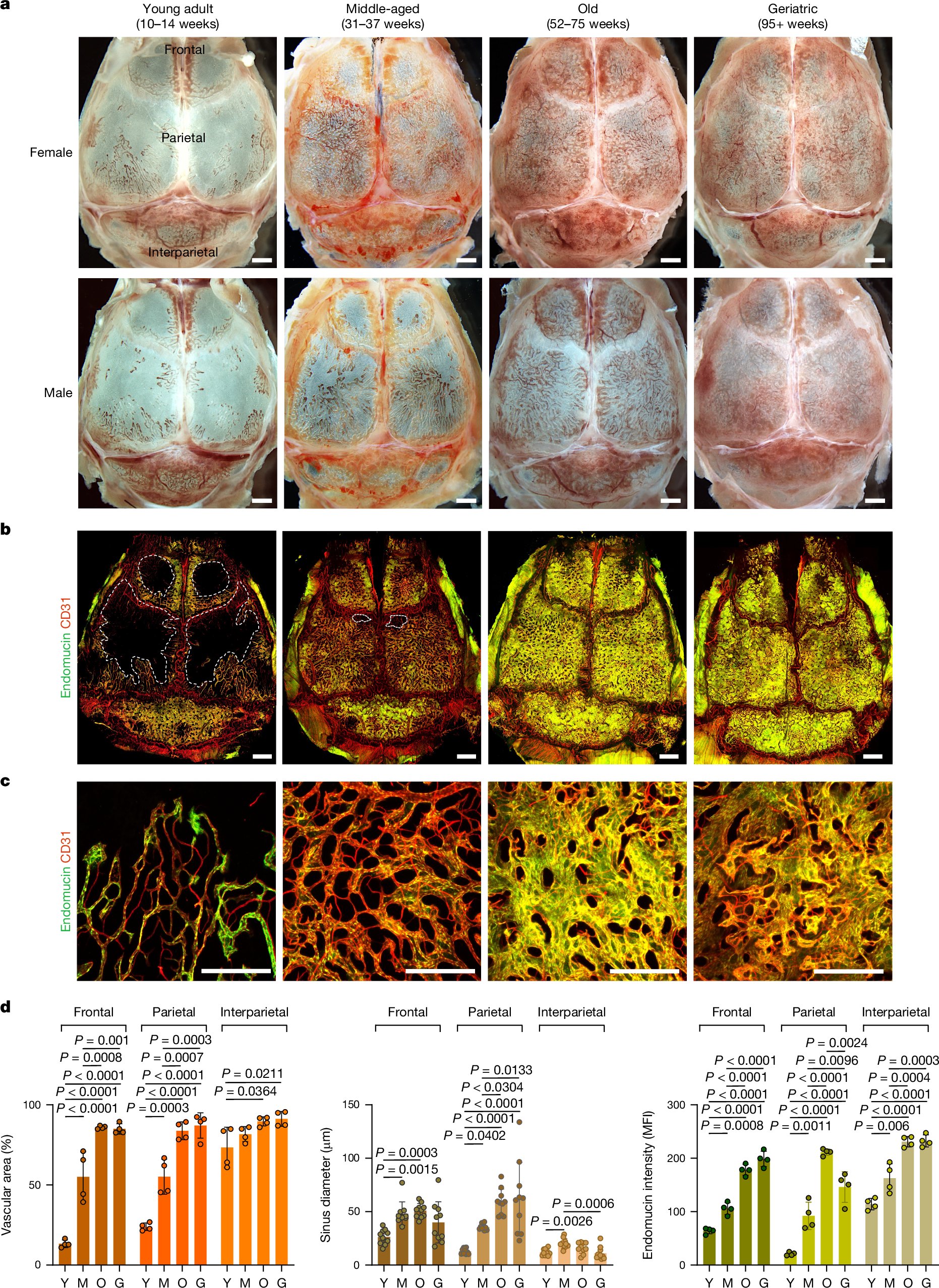 vajkoczy's tweet card. Nature - Skull bone marrow expands during adult life, exhibits lifelong vascular growth and increases its haematopoietic potential during ageing.