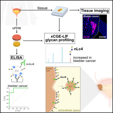 CellRepMed's tweet card. Moreira et al. show that the glycosphingolipid nLc4 is increased in bladder cancer tissue and patients’ urine. nLc4 is selectively expressed in tumor cells and secreted via extracellular vesicles....