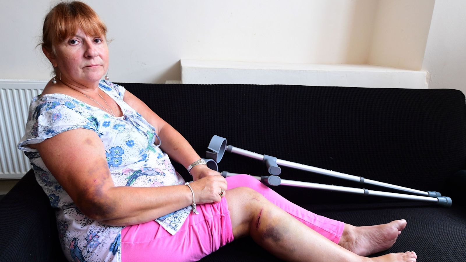 ITVChannelTV's tweet card. A woman is calling for tighter regulation on e-bikes after she was injured on a birthday night out. | ITV News Granada