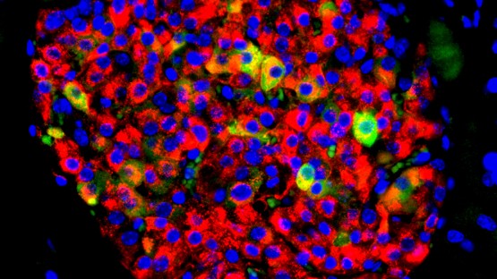 CornellGrad's tweet card. Eventual proof of a clear association between genes that express a salivary enzyme and Type 2 diabetes could lead to genetically testing people at birth to predict their susceptibility.