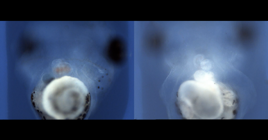 ariConference's tweet card. Variants in genes tied to both conditions derail the formation of cilia, the tiny hair-like structure found on almost every cell in the body, a new study finds.