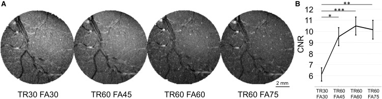NeuroCellPress's tweet card. As a step toward human translation, Wang et al. demonstrate, without using contrast agents, the ability to map fine-scale cerebrovasculature (intracortical arterioles and venules) in vivo in primates...
