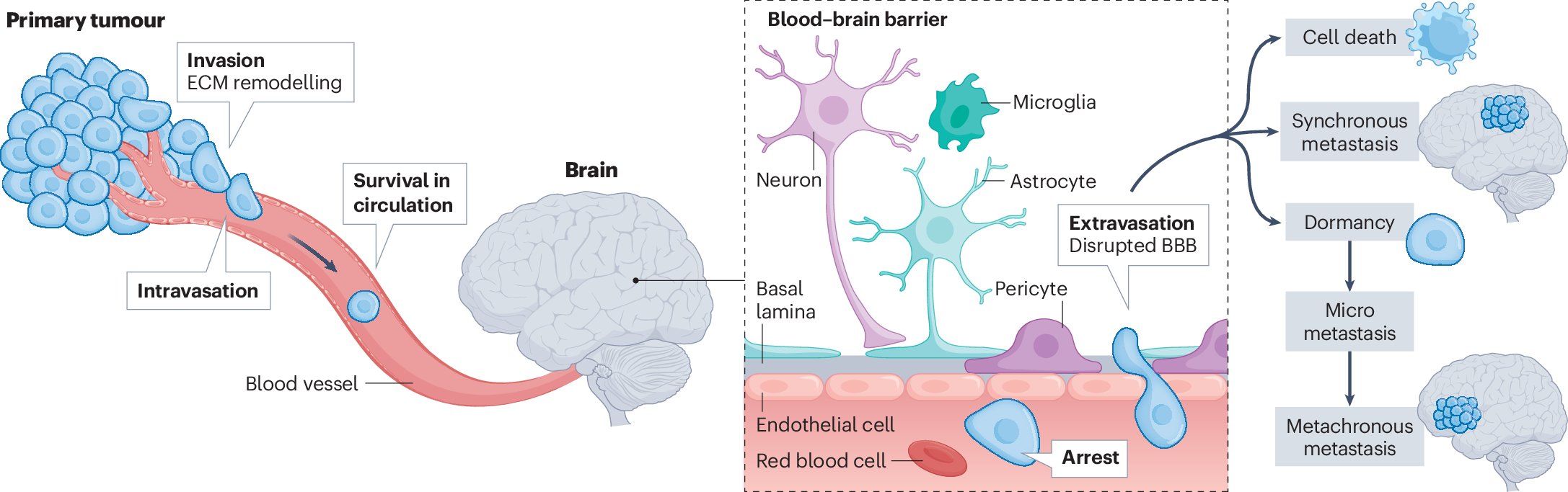 iPatho1's tweet card. Nature Reviews Cancer - In this Review, Parida and Malladi summarize the metabolic adaptations of tumour cells upon dissemination to the brain, outline the metabolic crosstalk between cancer and...