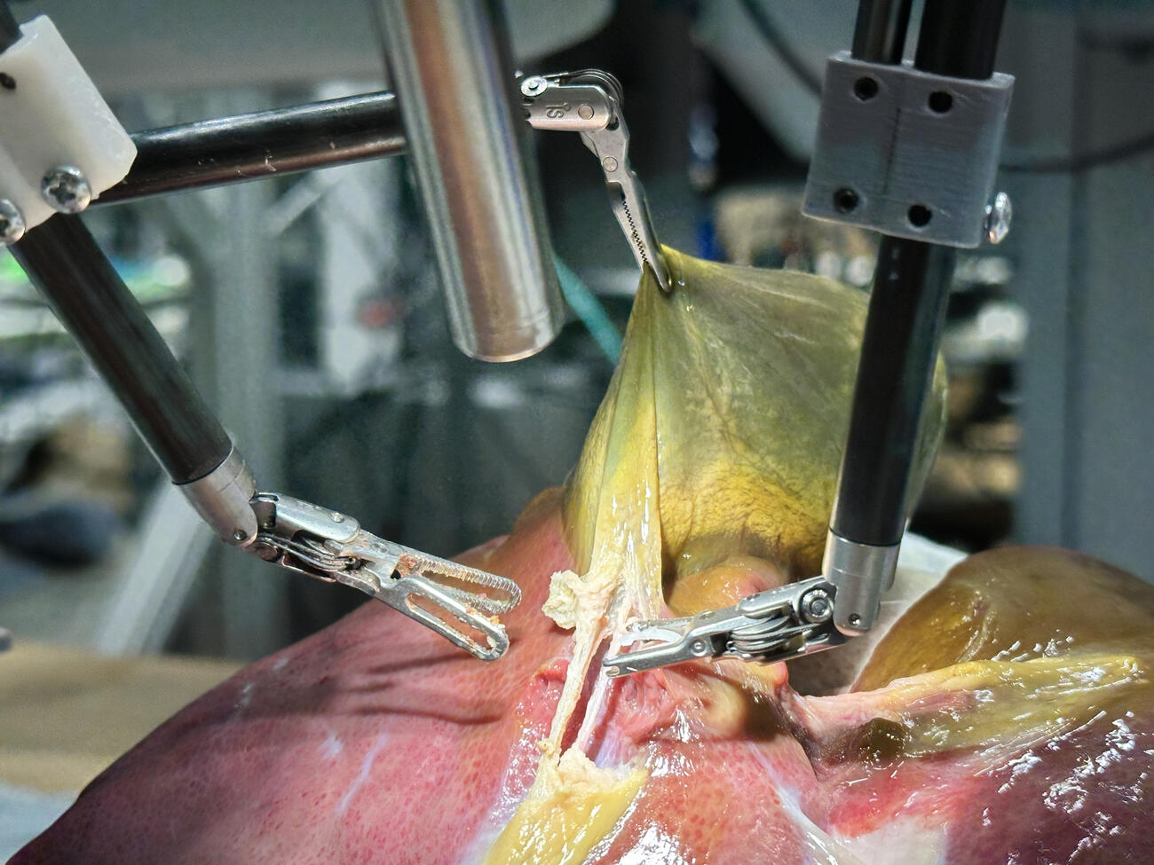 JHUMCEH's tweet card. In work led by Johns Hopkins researchers, the robot performed unflappably across trials and with the expertise of a skilled human surgeon, even during unexpected scenarios typical in real life...