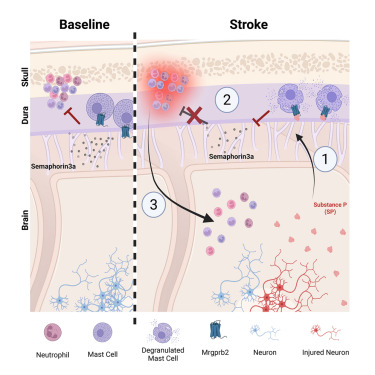 zenbrainest's tweet card. Meningeal mast cells, via the receptor Mrgprb2/X2, orchestrate brain inflammation after stroke by recruiting and promoting the transfer of skull bone marrow neutrophils into the brain, highlighting...