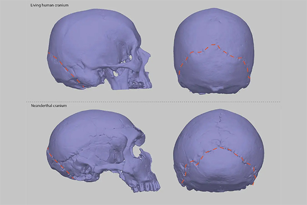 SFUENV's tweet card. A new Simon Fraser University-led study reveals interbreeding between humans and their ancient cousins, Neanderthals, as the likely origin of a neurological condition estimated to impact up to one...