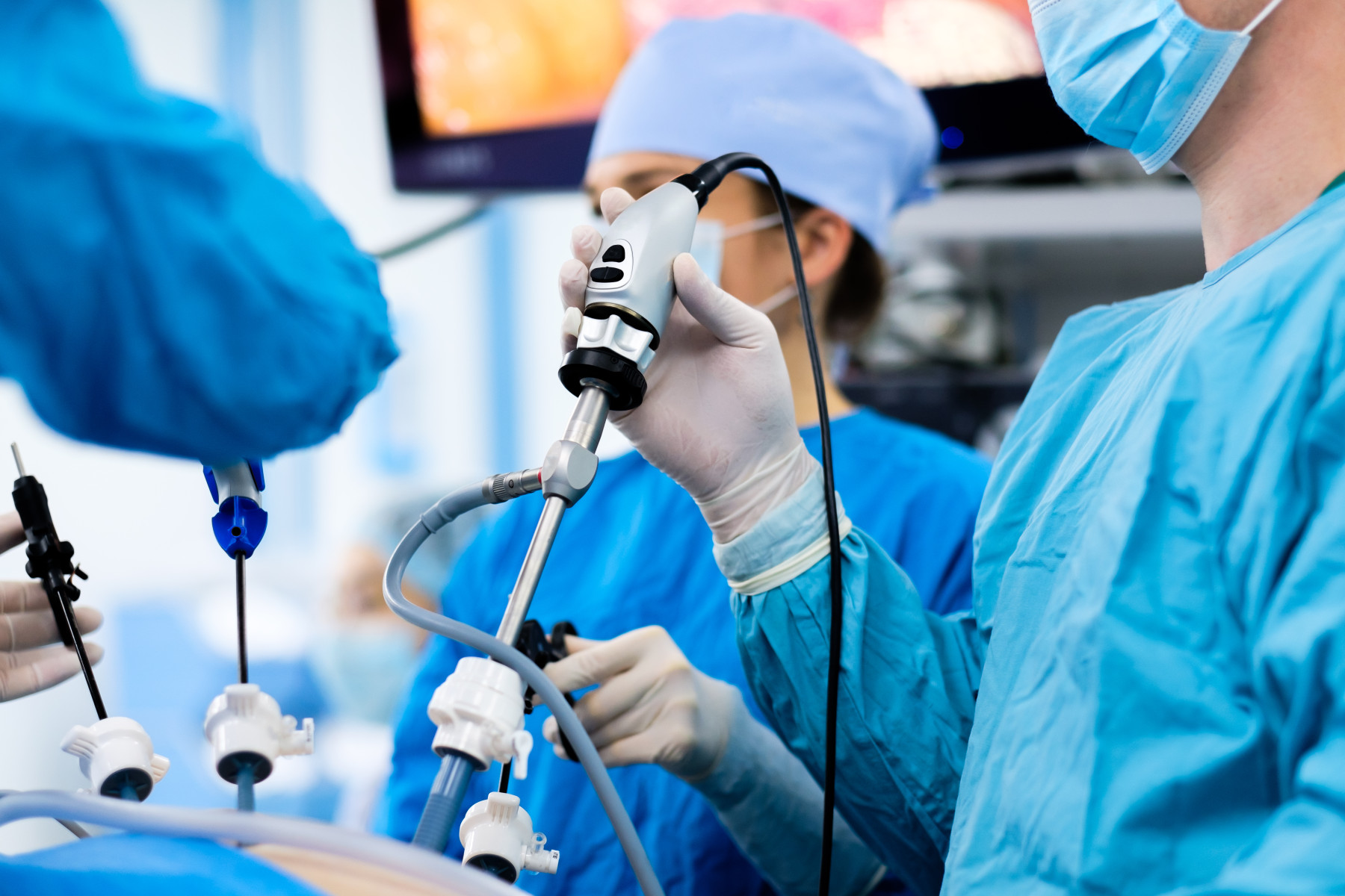 CSCancerCenter's tweet card. After reviewing hundreds of hours of surgical video, a team led by Cedars-Sinai investigators has created a system that links specific steps performed during a surgical procedure to how well patients...