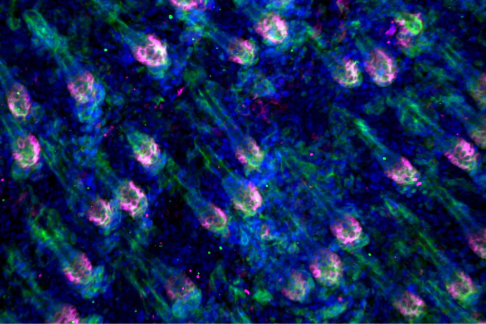 RockefellerUniv's tweet card. Serine triggers a process that turns hair follicle stem cells into skin repair specialists—and diet may have a role to play.