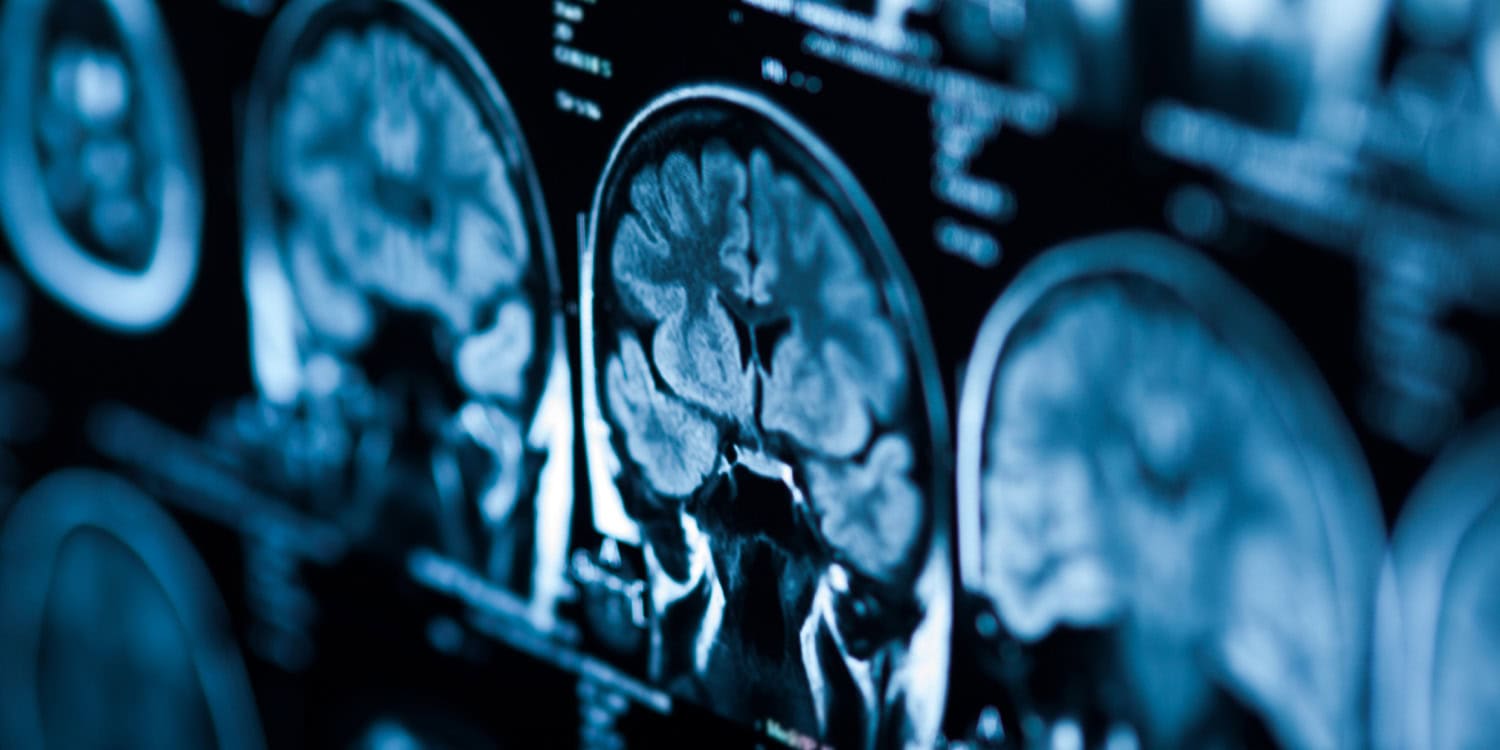 PsyPost's tweet card. Living near trees and parks may do more than lift children’s spirits—it may shape their brains. New research reveals that greener neighborhoods are associated with stronger brain structure, better...
