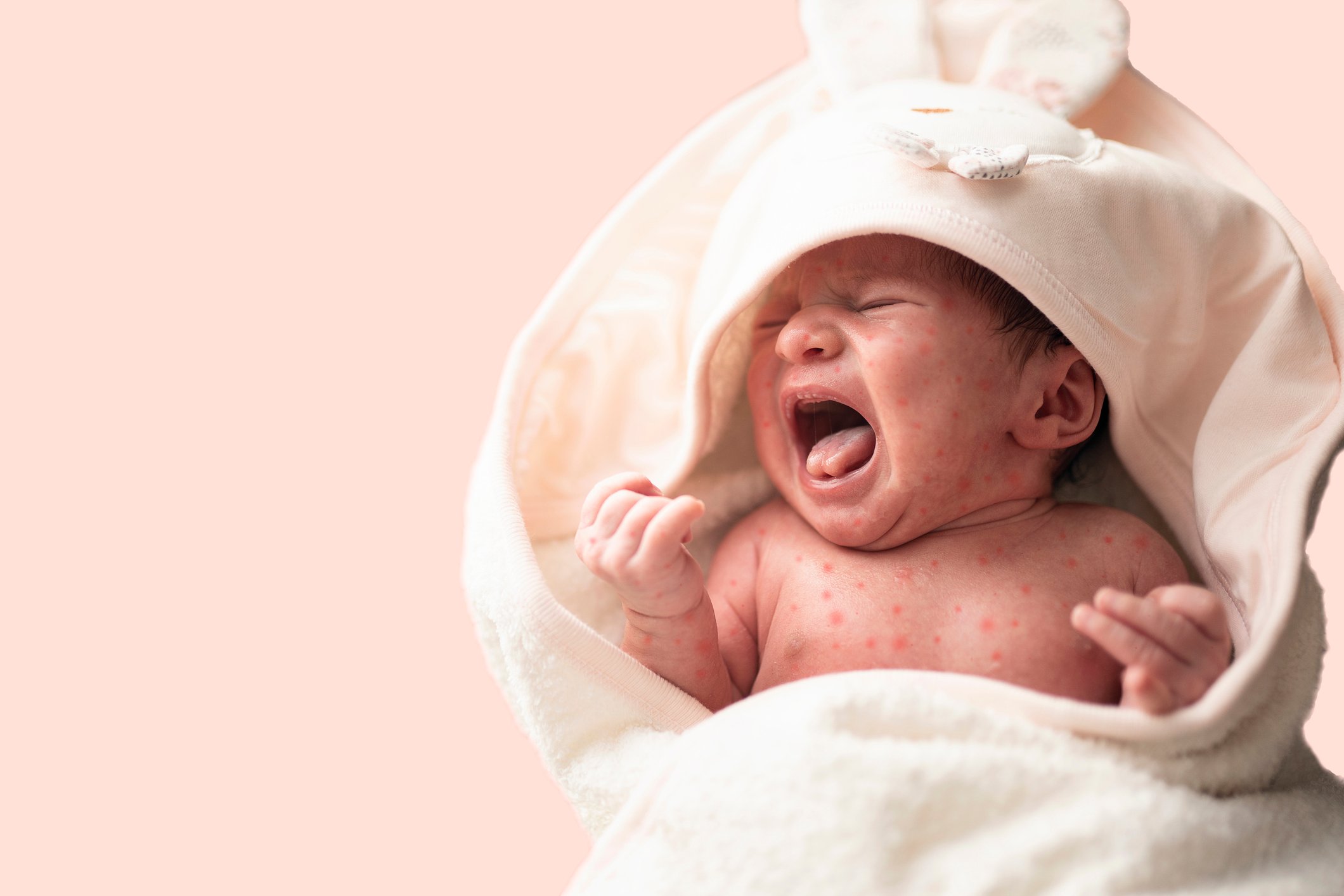 garthrapeport's tweet card. As measles cases surge to record levels in the U.S., Department of Health and Human Services (HHS) Secretary R | As measles cases surge to record levels in the U.S., Department of Health and Human...