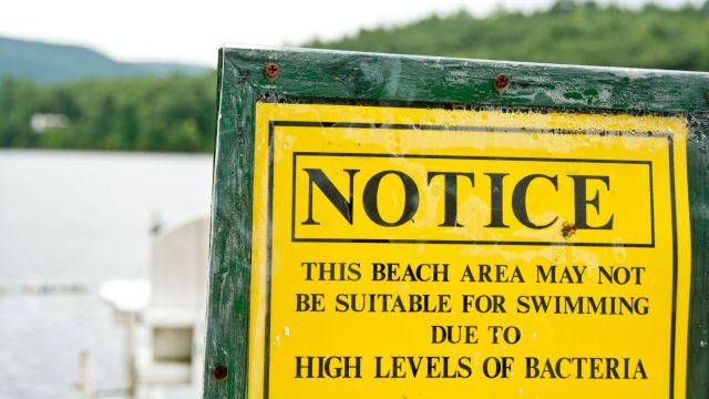 WKRG's tweet card. SANTA ROSA COUNTY, Fla. (WKRG) — Swimmers at Navarre Beach should avoid certain areas because of water quality issues. According to a Florida Department of Health Santa Rosa County news release, te…