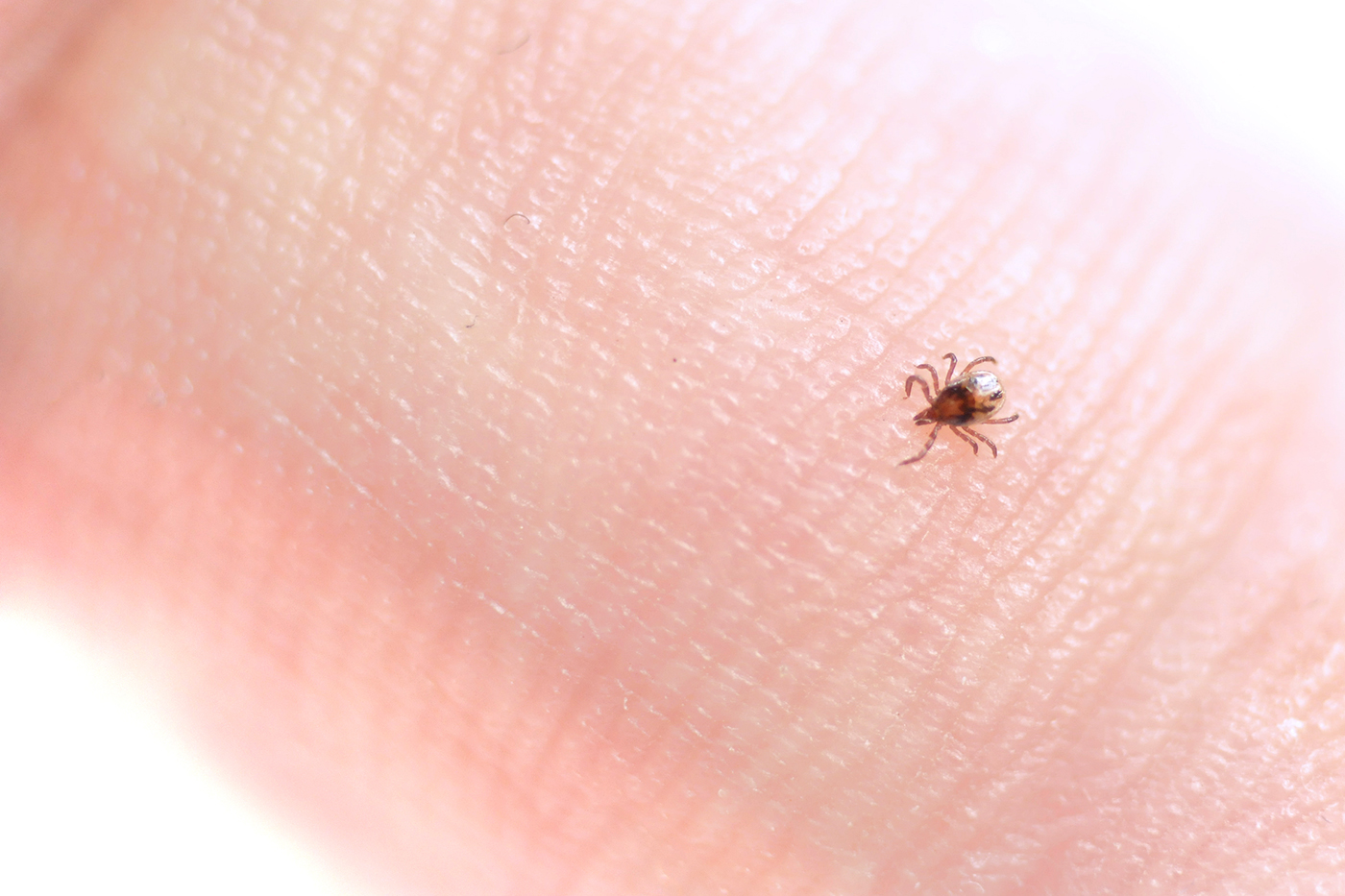 NortheasternCOS's tweet card. Follow five expert-backed tips for preventing tick bites, including how to check for ticks, protect your pets and treat your clothes.