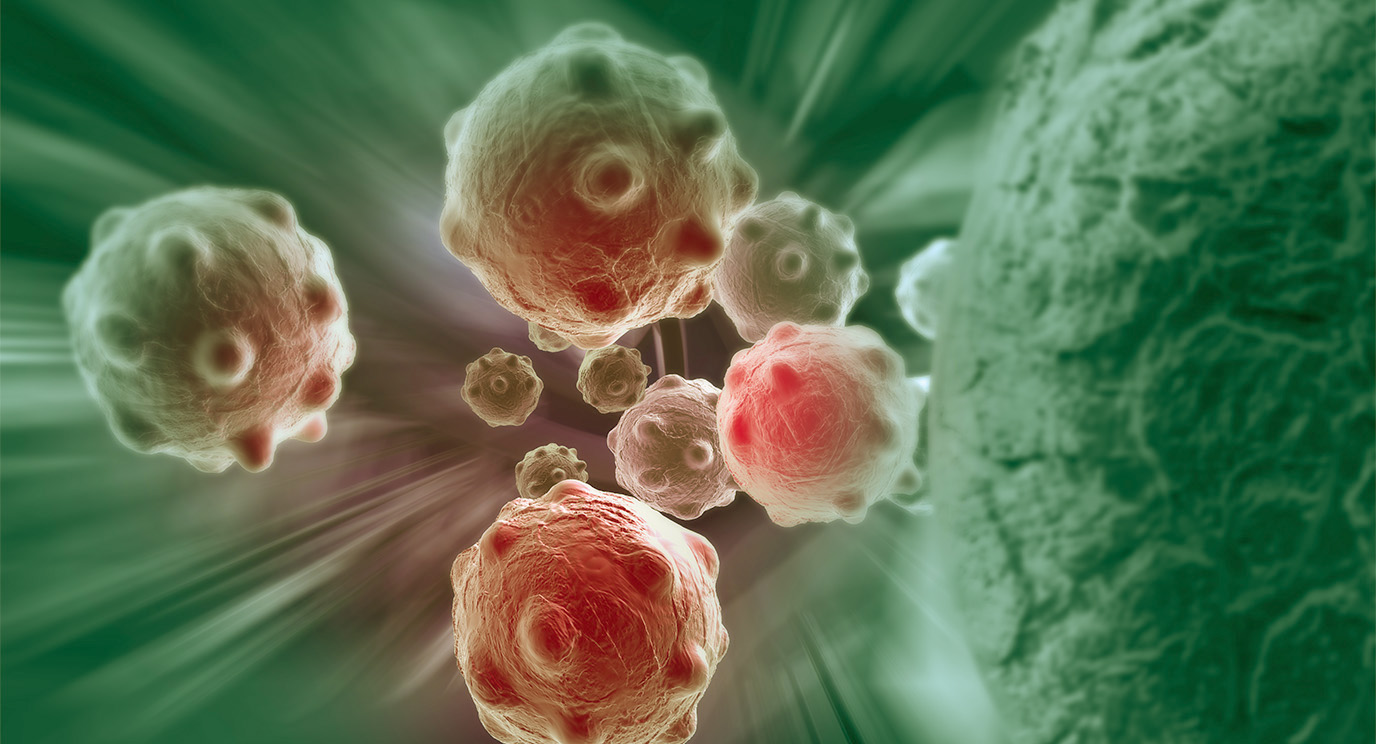 SGoswamiMDPhD's tweet card. Surgery enhances immunotherapy in advanced kidney cancer