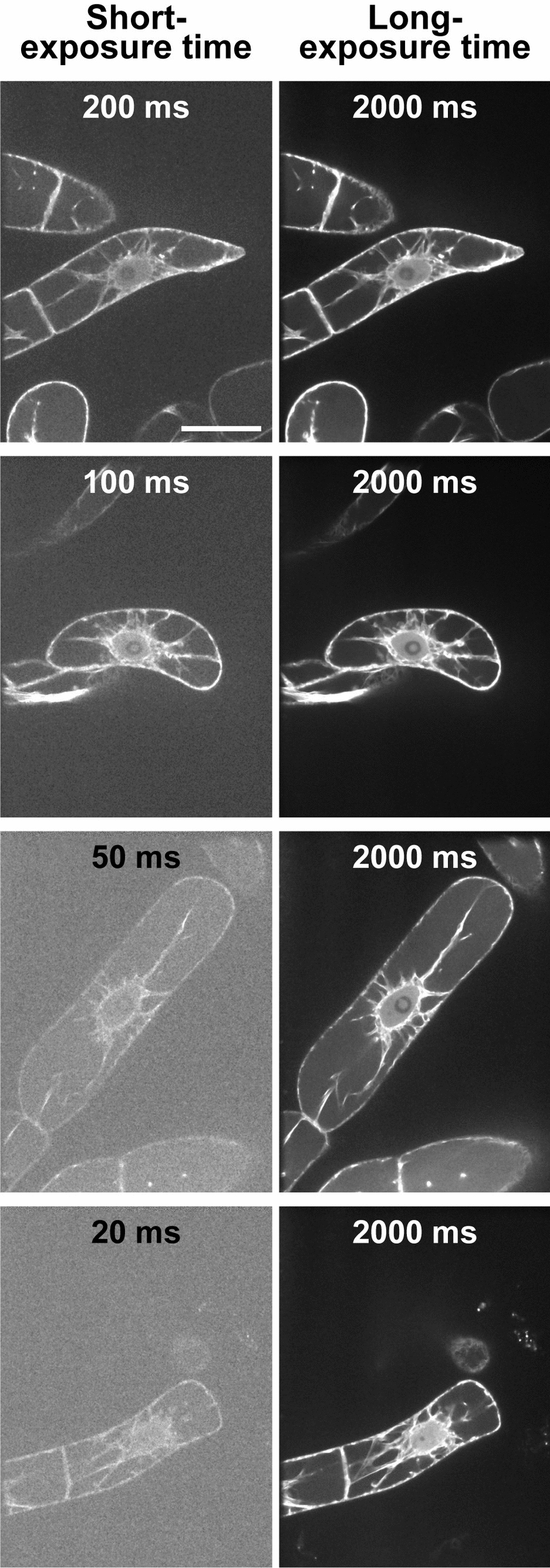 _ta93's tweet card. Plant Cell Reports - Using deep learning-based image restoration, we achieved high-resolution 4D imaging with minimal photodamage, revealing distinct localization and suggesting Lifeact-RFP-labeled...