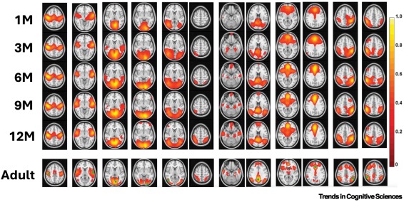 DrJamesBooth's tweet card. Functional brain networks emerge prenatally, grow interactively during the first years of life, and optimize both within-network topology and between-network interactions as individuals age. This...