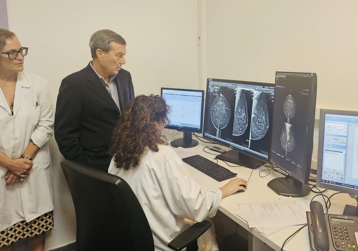 manoletux's tweet card. El departamento de Elche-Crevillente ha sido el último en el que se ha implantado este sistema | Gracias a él ya se han hecho 400.000 estudios radiológicos en toda la Com