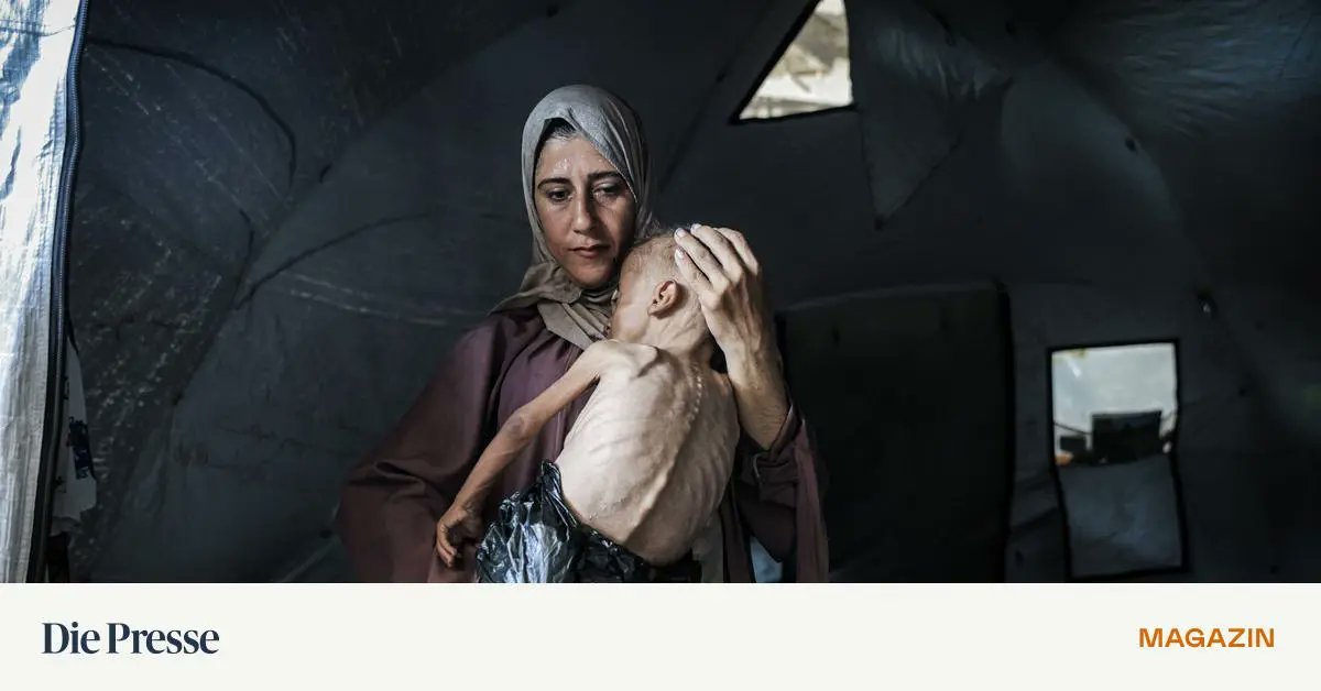 DiePressecom's tweet card. Ein völlig unterernährter eineinhalbjähriger Bub in den Armen seiner Mutter: Das Bild des Fotografen Ahmed al-Arini geht um die Welt. Der BBC erzählte er die Hintergründe.