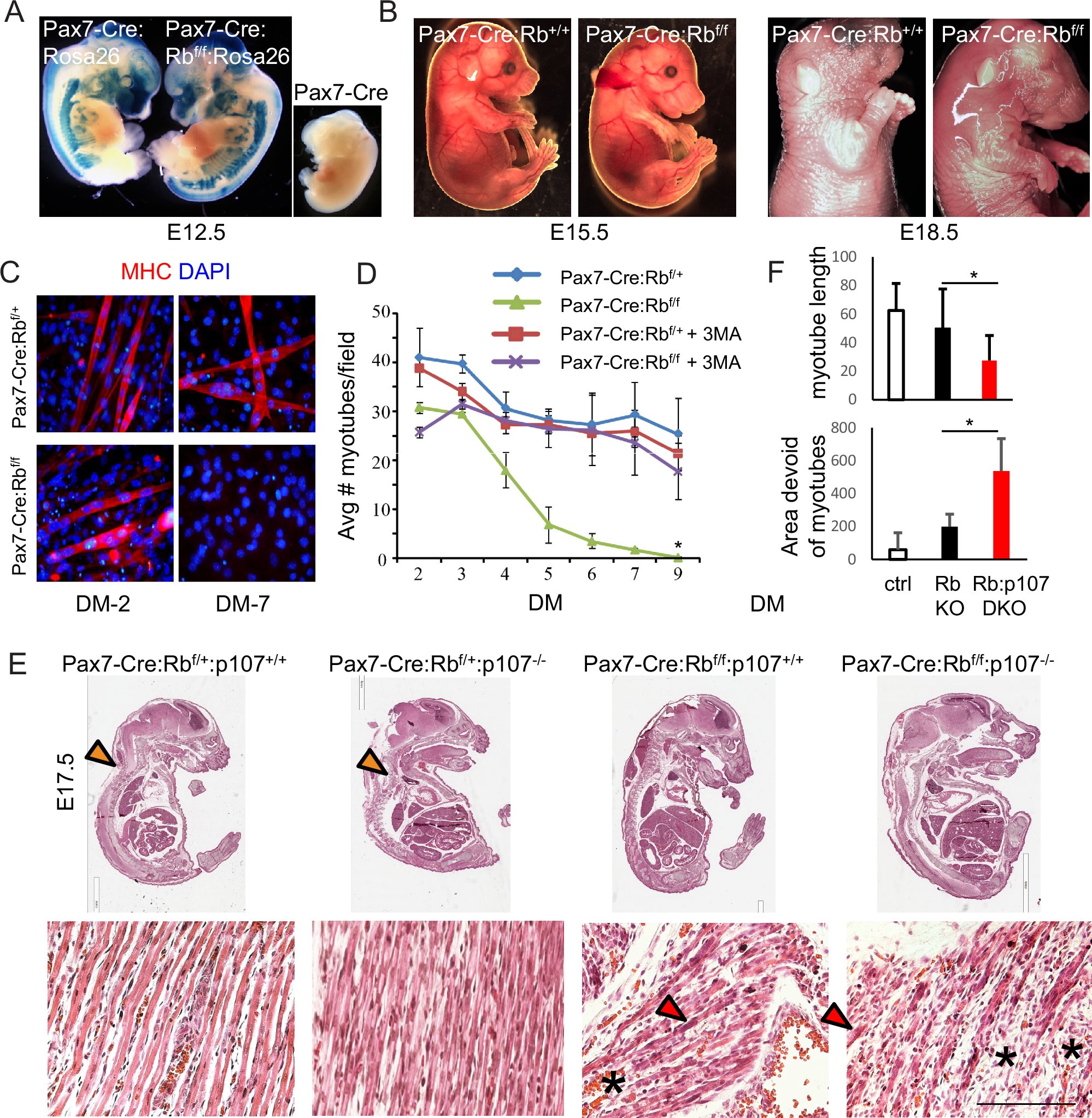 Matt_Muscle_Guy's tweet card. Oncogene - The tumor suppressor pRb and its relative p130 are required to maintain murine adult skeletal muscle homeostasis