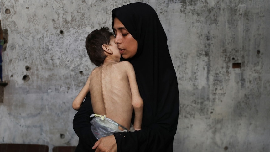 CVTorg's tweet card. Media organisations, including the ABC, are wrestling with the particular use of a word to describe the death and destruction: genocide. But what constitutes Genocide? Does the legal definition fit...