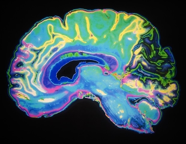 AutismeInfo's tweet card. The origin of some neuropsychiatric diseases, such as autism, bipolar disorder, or depression, and certain neurodegenerative diseases, Alzheimer's and Parkinson's, can be found in very early stages...