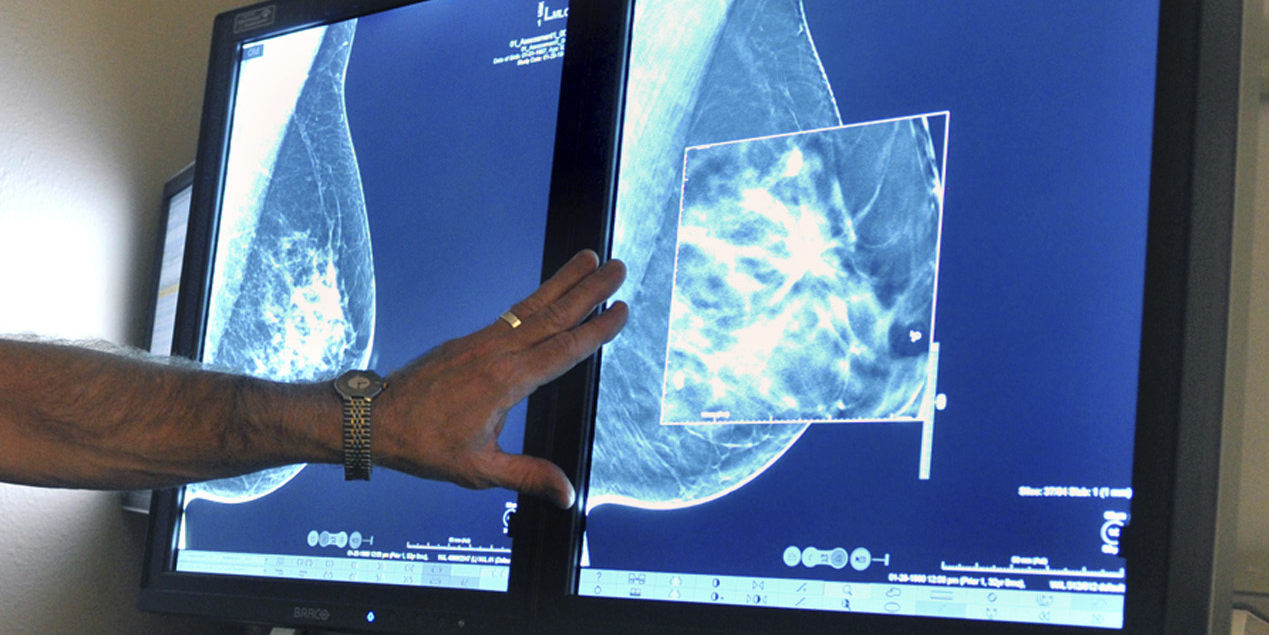 NatashaMongaMD's tweet card. New guidance called for mammograms every other year, while some doctors urged annual checks.