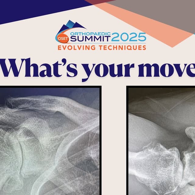 AnandMurthiMD's tweet card. Orthopaedic Summit 2025 (@ortho_summit) • Instagram photo