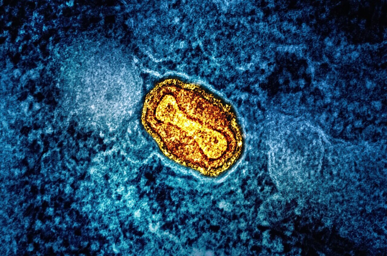 Conti_Clinical's tweet card. Ghana has recorded its first death from Mpox, health authorities confirmed Sunday, amid a sharp rise in new infections in the West African country.