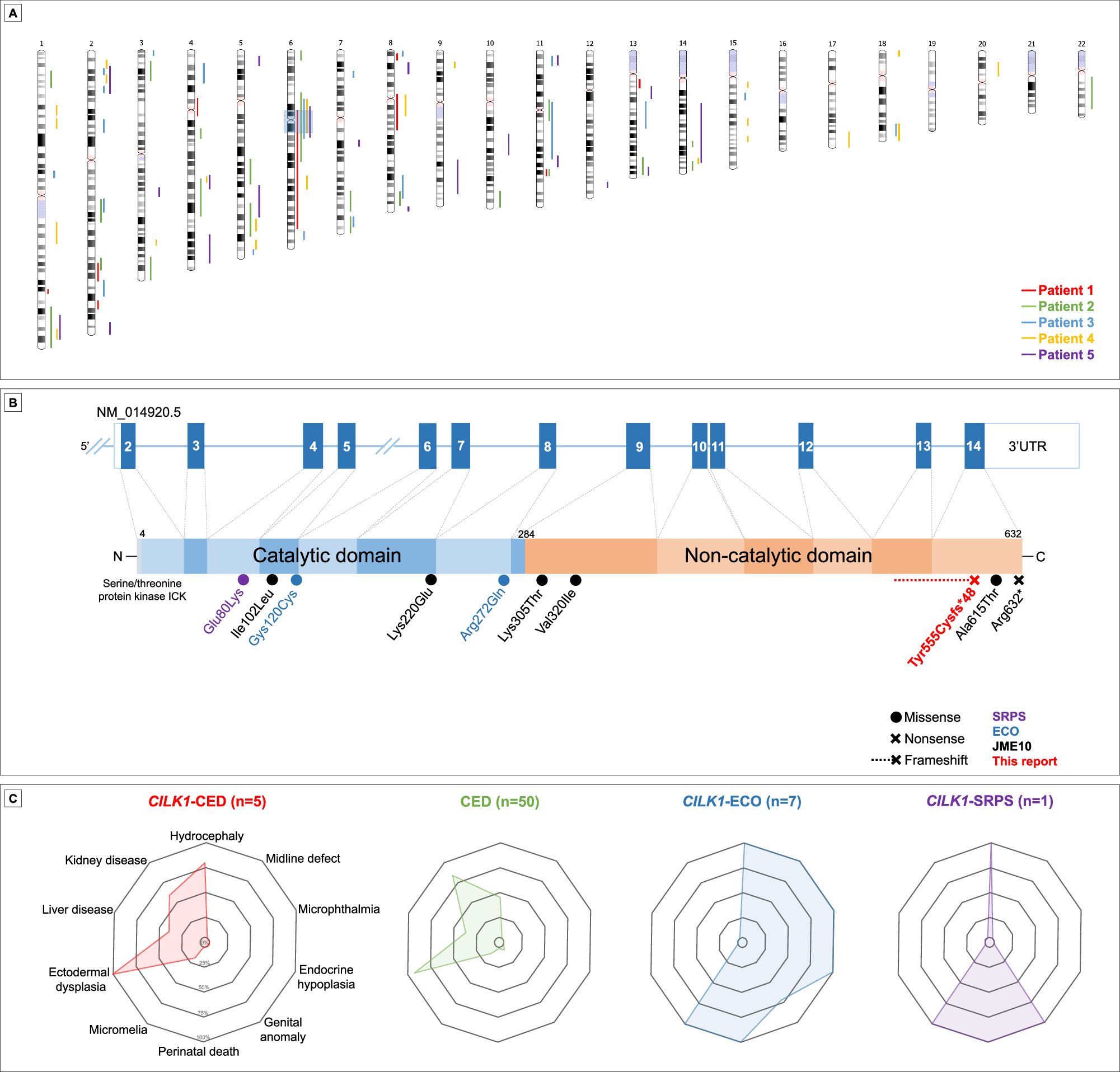 ejhg_journal's tweet card. European Journal of Human Genetics - A homozygous frameshift variant in the CILK1 gene causes cranioectodermal dysplasia