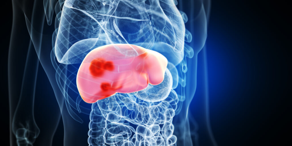 emulateinc's tweet card. Drug-induced liver injury (DILI) remains a persistent challenge in drug development, endangering patient safety and delaying the availability of critical therapies. Just days ago, the FDA issued a...