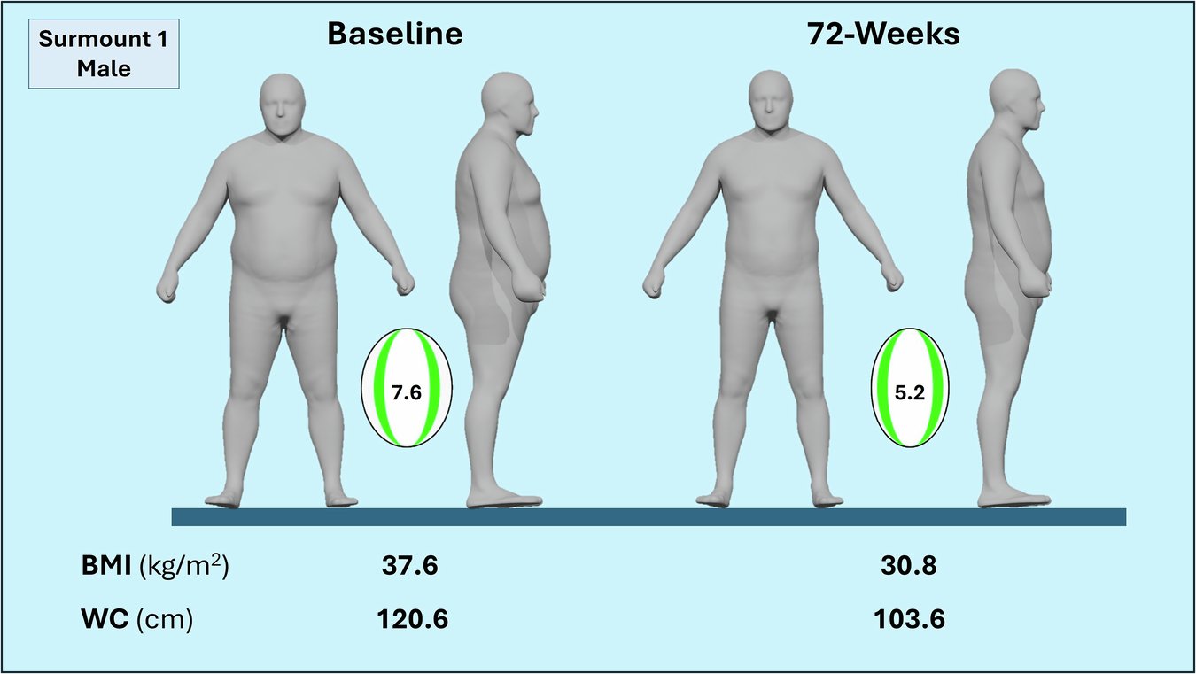 MarcusDGon's tweet card. International Journal of Obesity - Visual demonstration of weight loss and health risk improvement with a dual GIP and GLP-1 receptor agonist