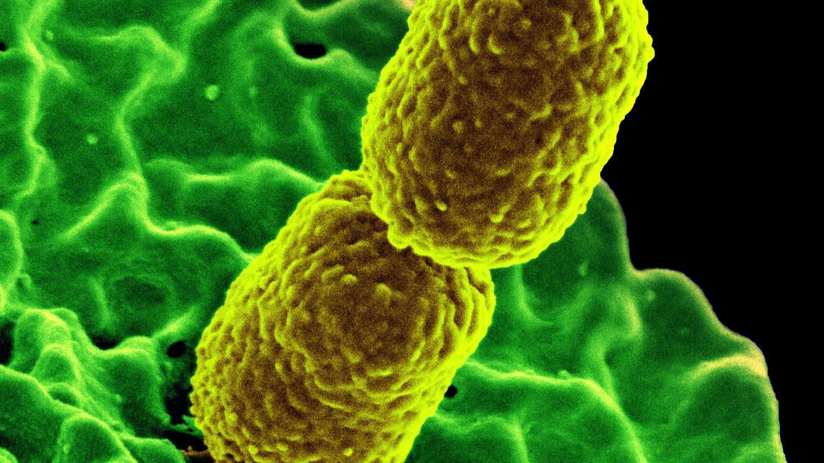 manojjangra91's tweet card. Very low concentration of the compound was able to kill all the bacteria in four to eight hours; there was no regrowth of bacteria even after a day.