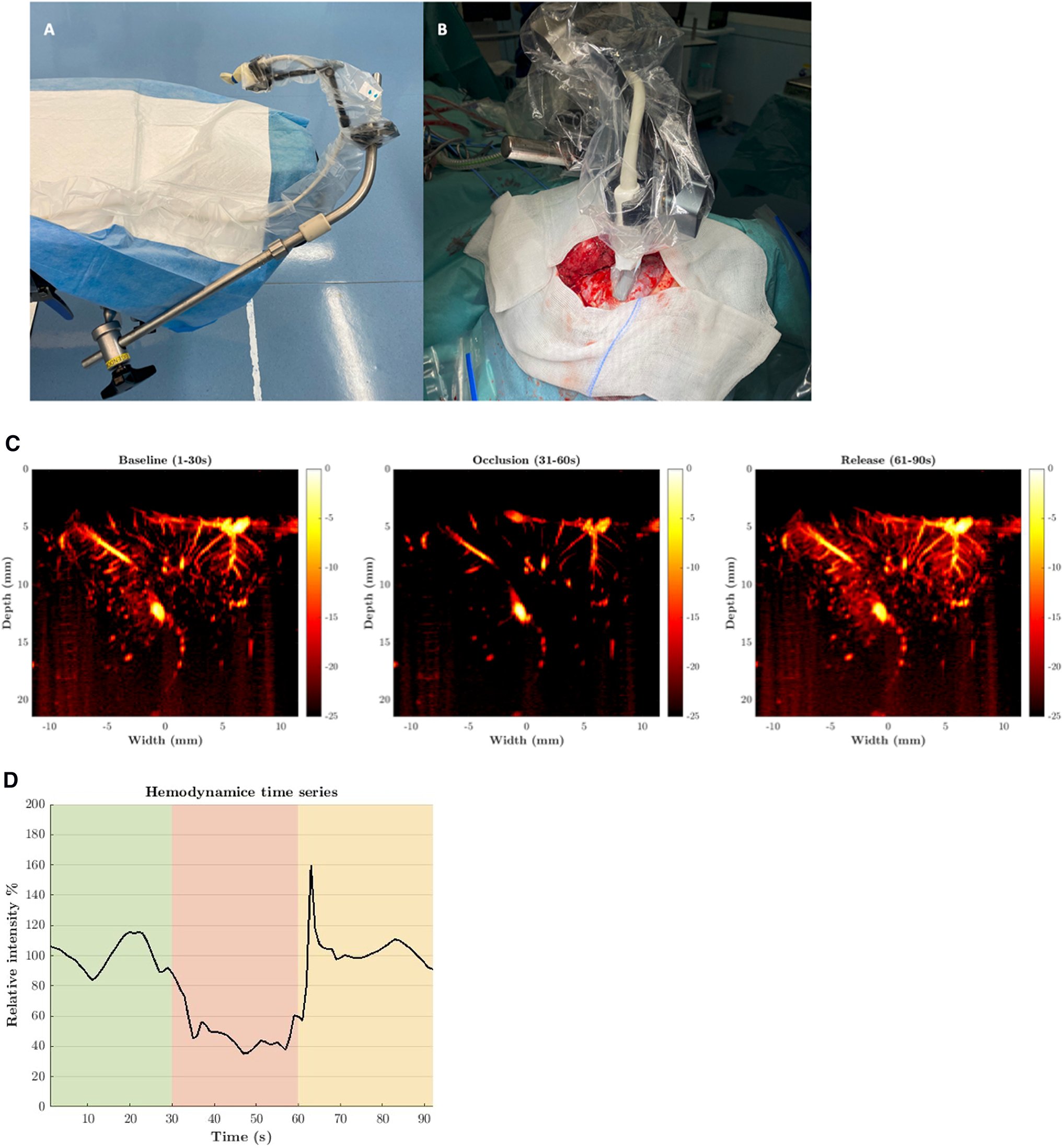 Boca_Scientific's tweet card. Scientific Reports - Intraoperative cerebral perfusion monitoring with ultrafast power doppler imaging