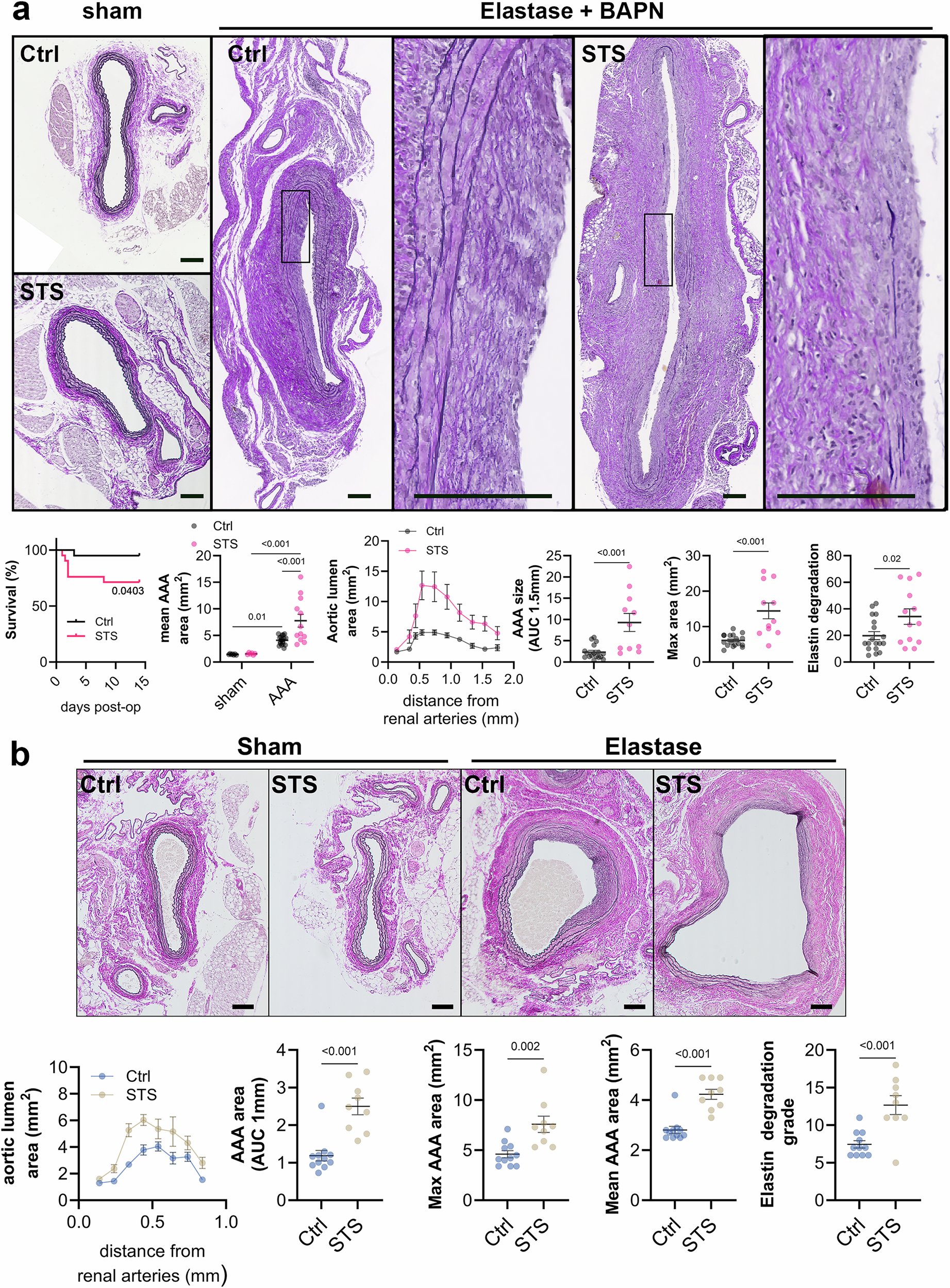 CommsMedicine's tweet card. Communications Medicine - Bechelli et al. evaluate the effect of sodium thiosulfate (STS), a hydrogen sulfide donor, on abdominal aortic aneurysm (AAA) progression in normotensive mice. They see...