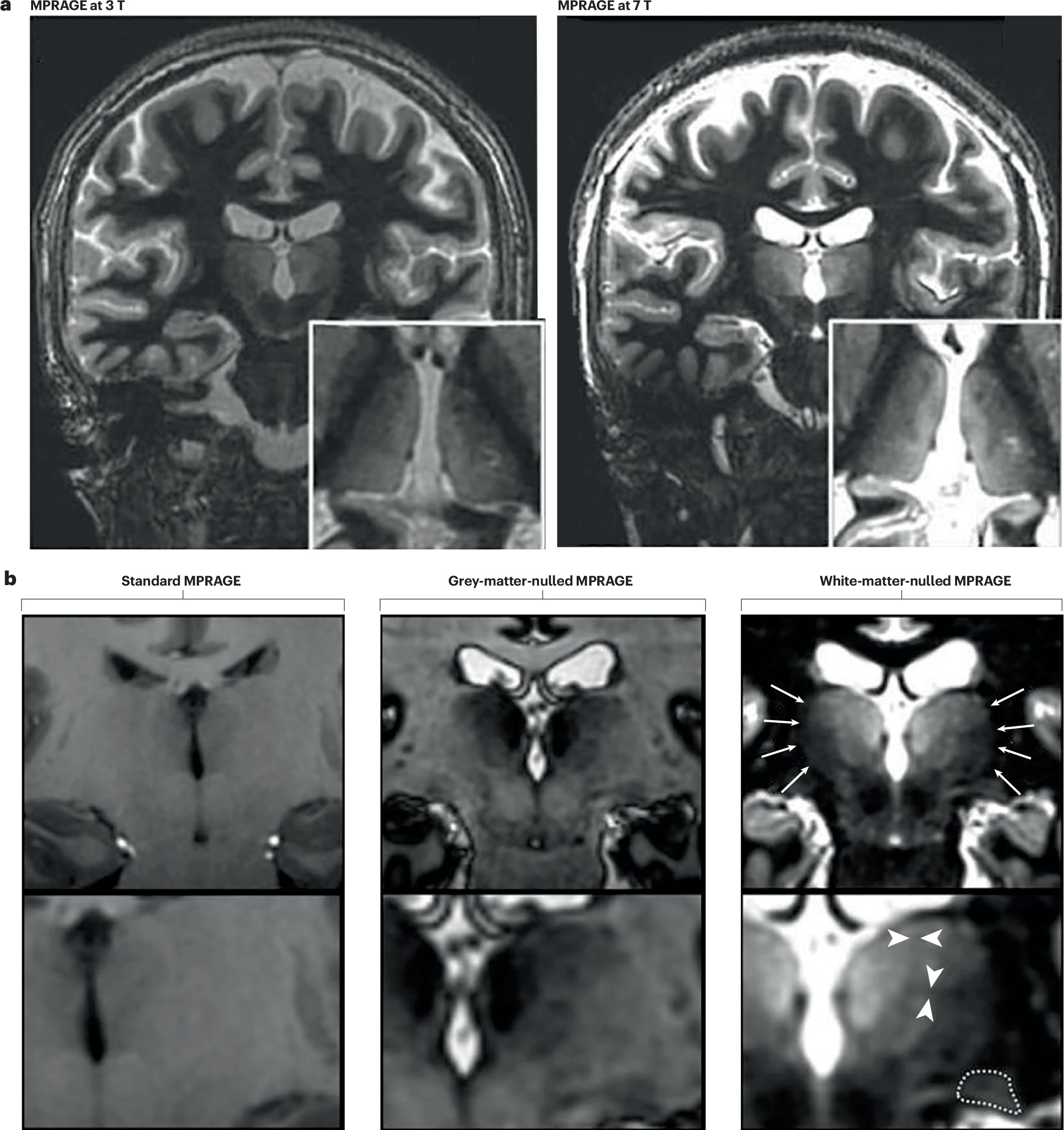 neoosho's tweet card. Nature Reviews Neuroscience - The human thalamus comprises multiple nuclei with distinct connectivity patterns and anatomical features; however, current neuroimaging approaches have a limited...