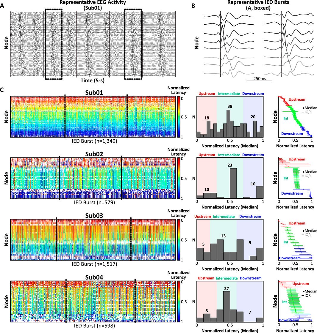 FrontNetPhysiol's tweet card. Interictal epileptiform discharges (IEDs) are pathologic hallmarks of epilepsy which frequently arise and spread through networks of functionally-connected b...