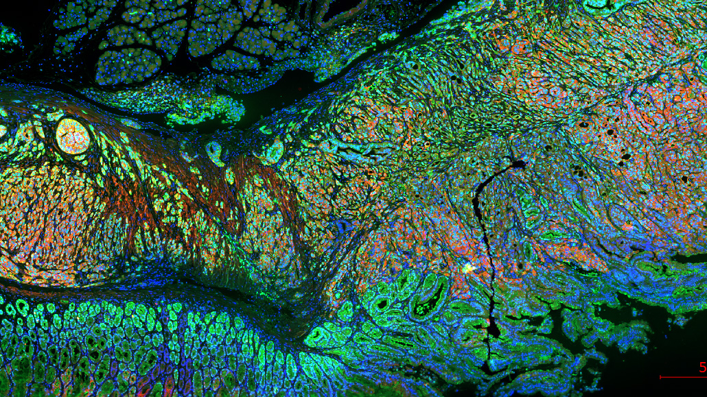 Gilbertson_Lab's tweet card. We are seeking to recruit a highly enthusiastic and motivated Research Assistant to join the group of Professor Richard Gilbertson at the Cancer Research UK Cambridge Institute. The Gilbertson lab is...